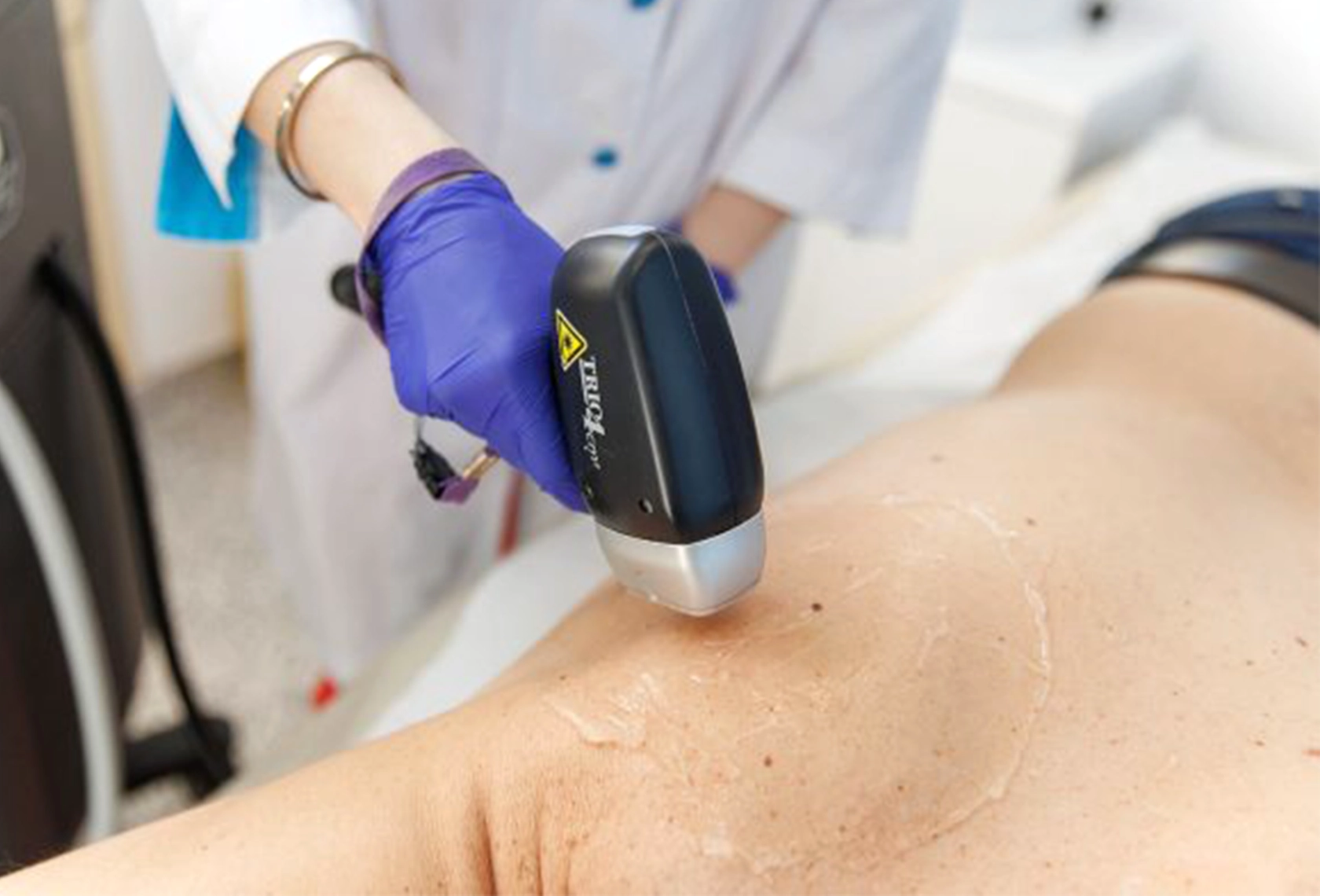 Full Body Laser Hair Removal for Men